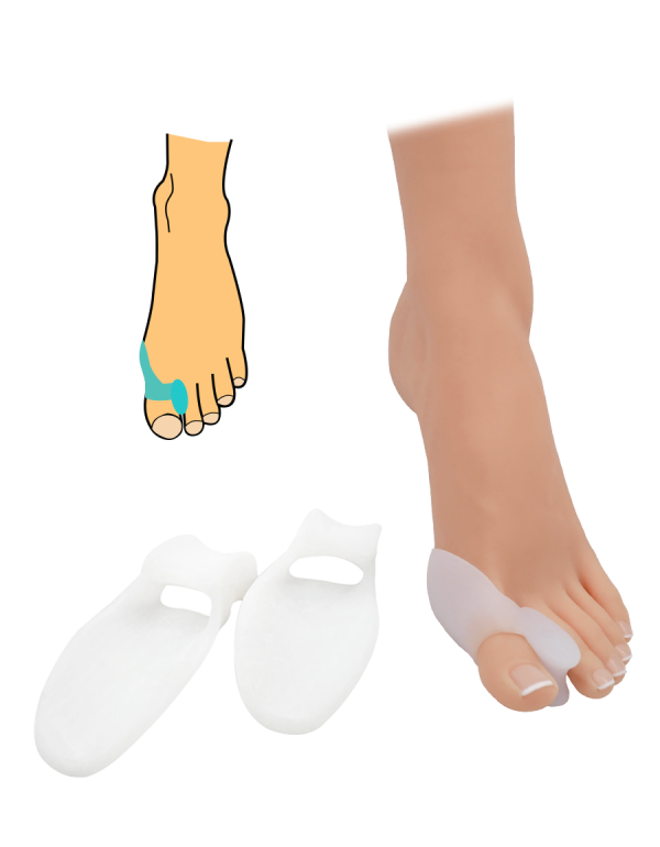 Hallux valgus protektor és korrektor - 2 db